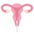PERFORM INSEMINATION