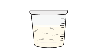 Collect semen sample