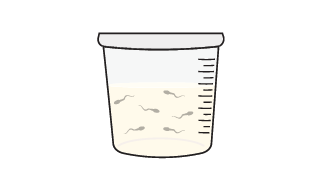 Collect semen sample