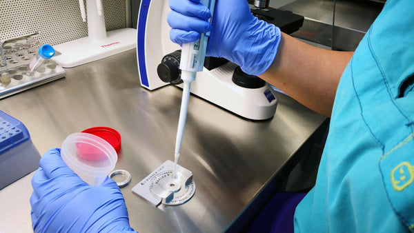 How frequently should we check sperm count?