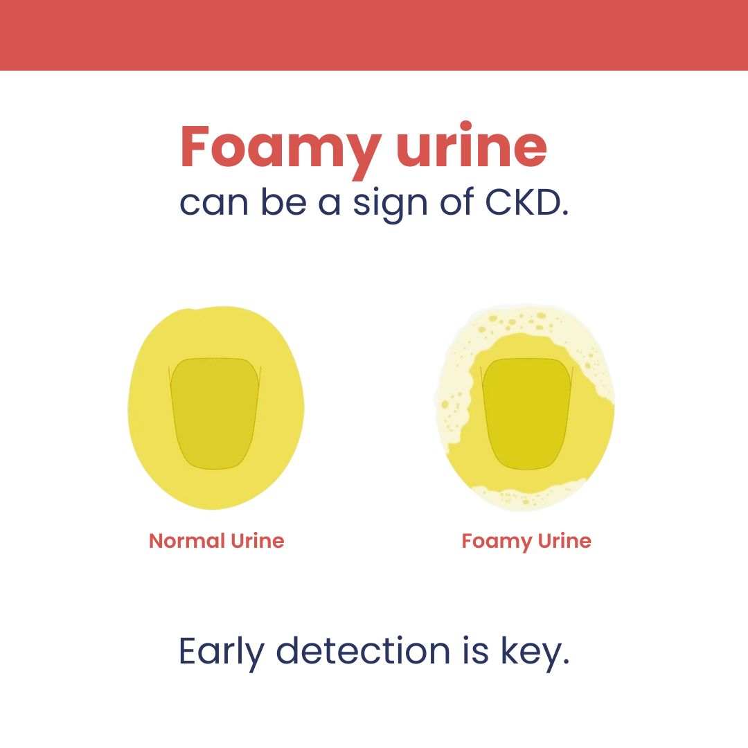 Neodocs Urine UACR Test Kit for Diabetes and Blood Pressure Patients