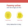 Neodocs Urine ACR Test Kit for Diabetes and Blood Pressure Patients