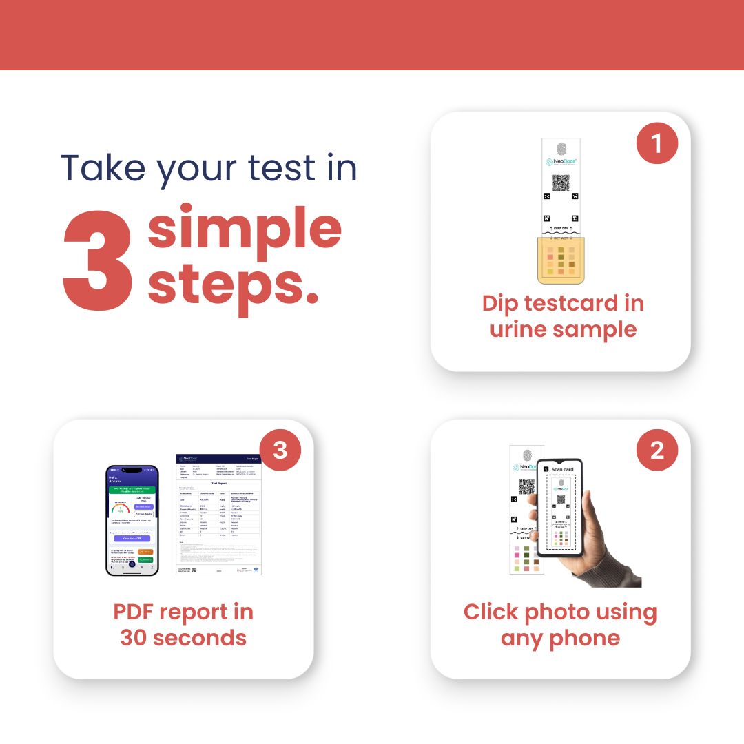 Neodocs Urine UACR Test Kit for Diabetes and Blood Pressure Patients